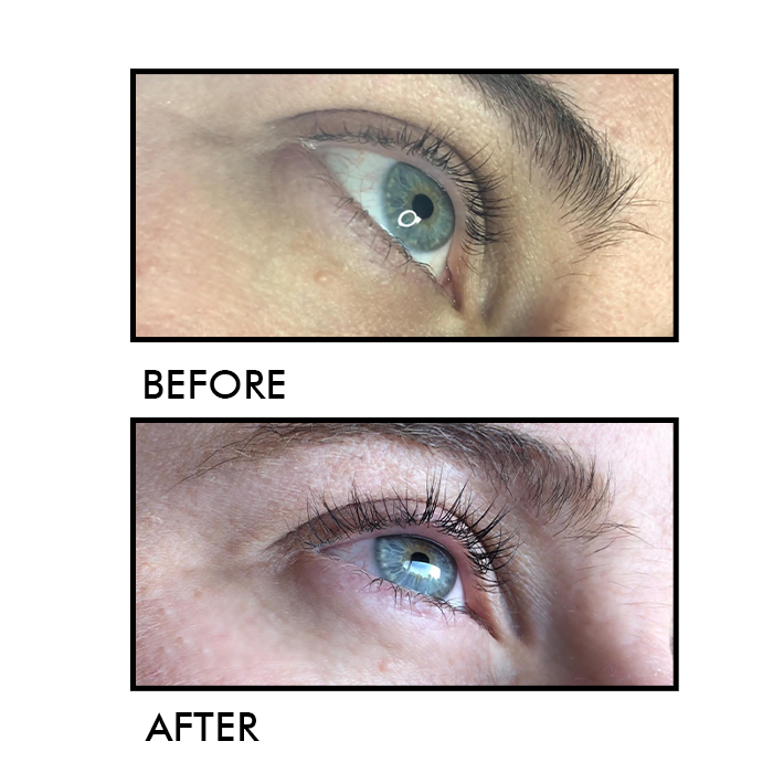 No36 lash growth serum before and after results